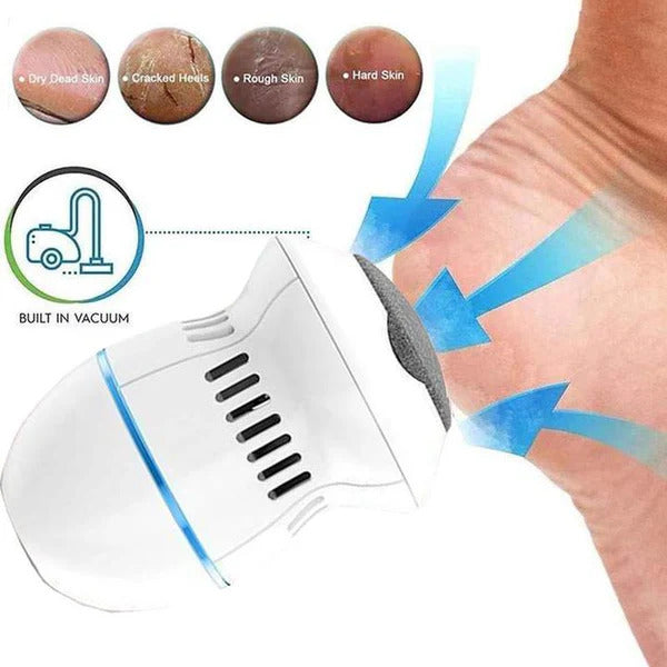 LZ At Home PediSander Vacuum Grinder Kit
