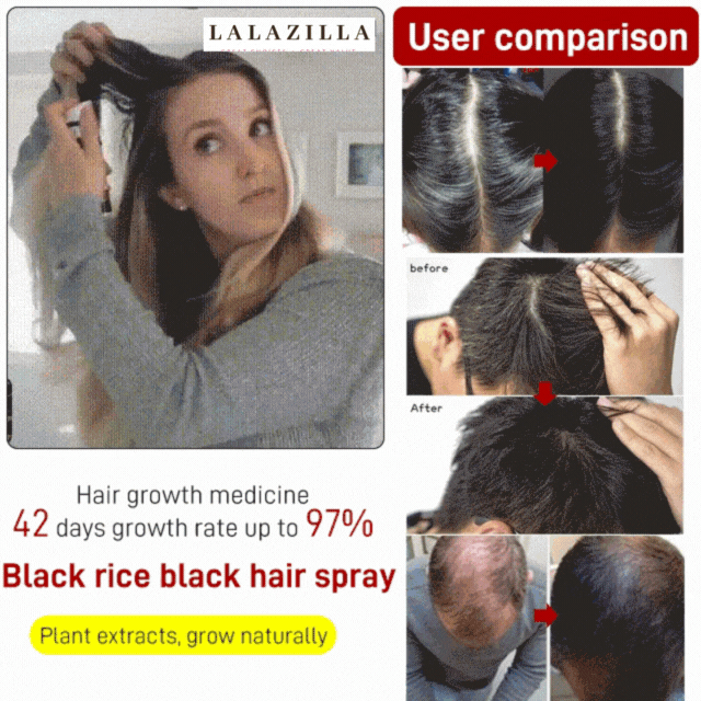 LZ Black Rice Hair Regrowth Spray