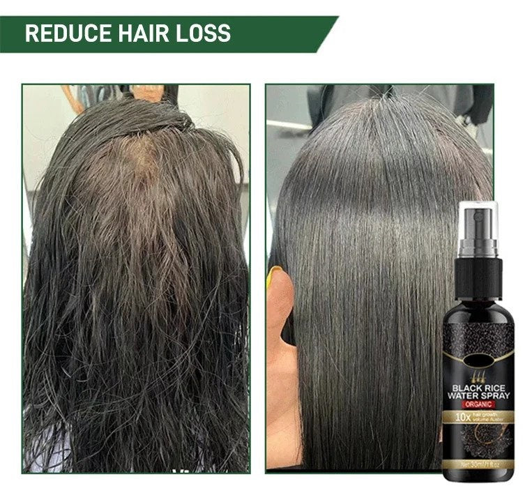 LZ Black Rice Hair Regrowth Spray